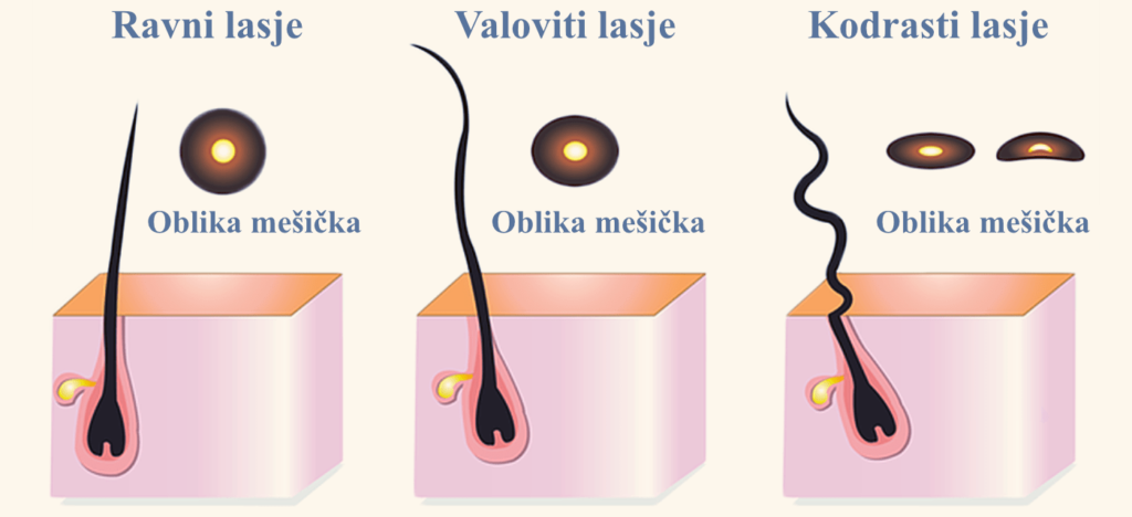 Naravna smer rasti in nakodranost las